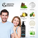 Minoxidil & Biotin Shampoo for Hair Growth - Enriched with Caffeine, Castor Oil & Onion - DHT Blocker for Thicker, Healthier Hair - Strengthening Formula for Men & Women